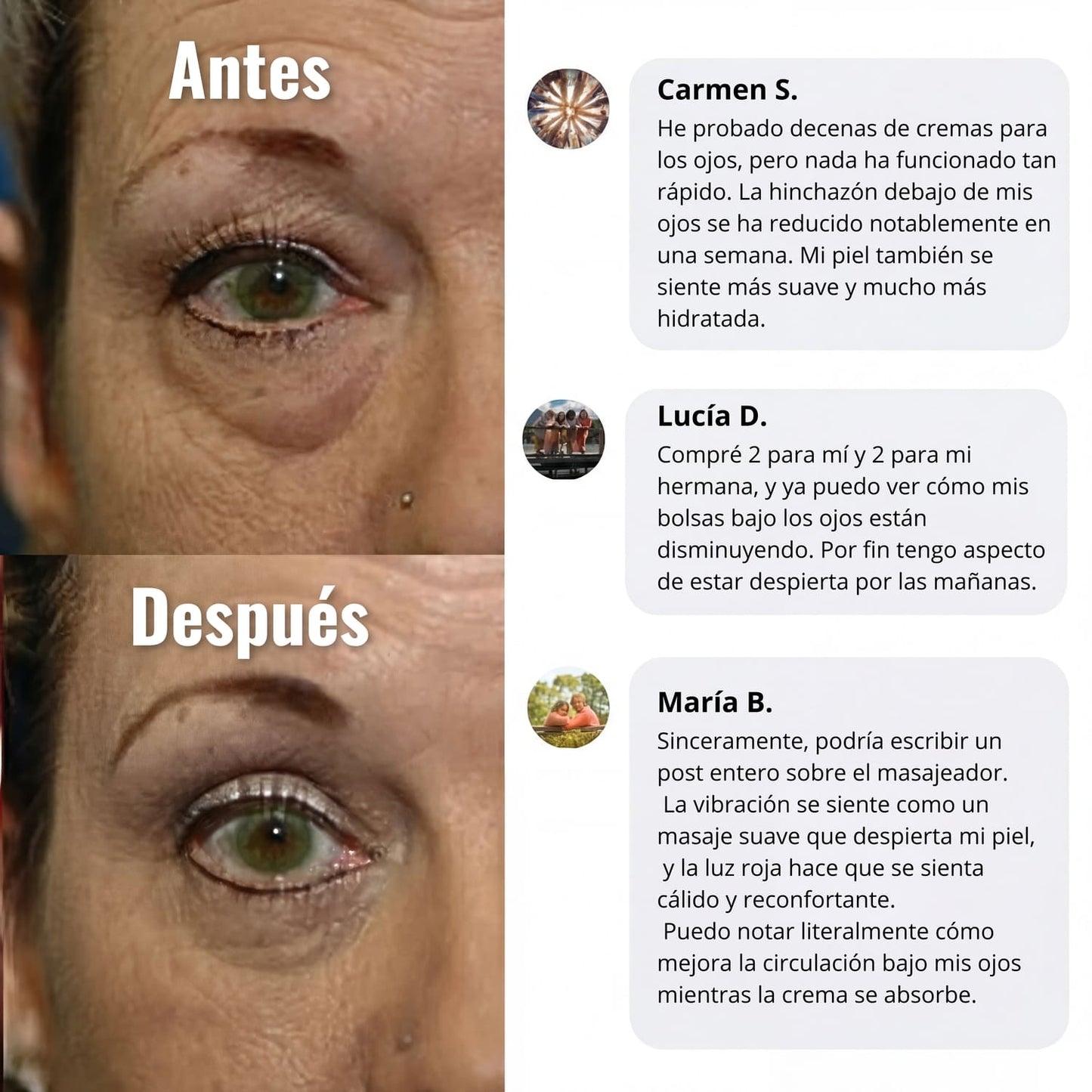 Crema de luz roja “eliminar ojos cansados”