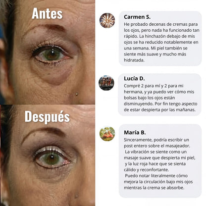 Crema de luz roja “eliminar ojos cansados”