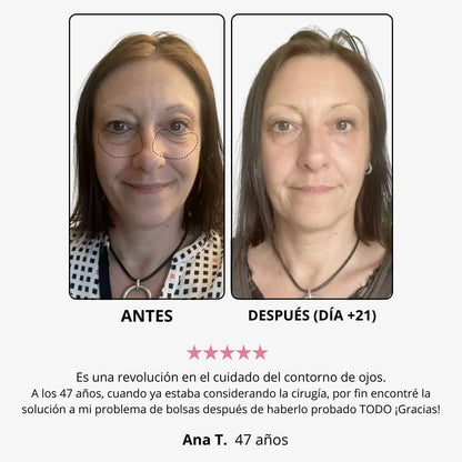 Crema de luz roja “eliminar ojos cansados”