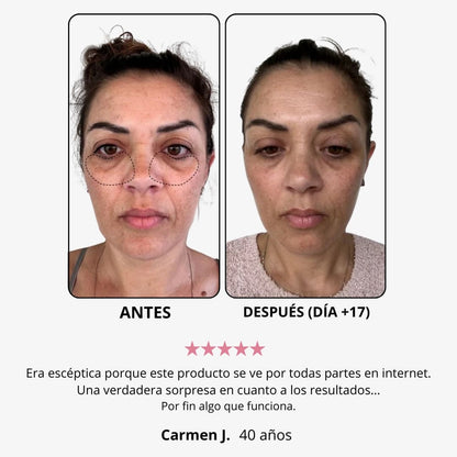 Crema de luz roja “eliminar ojos cansados”