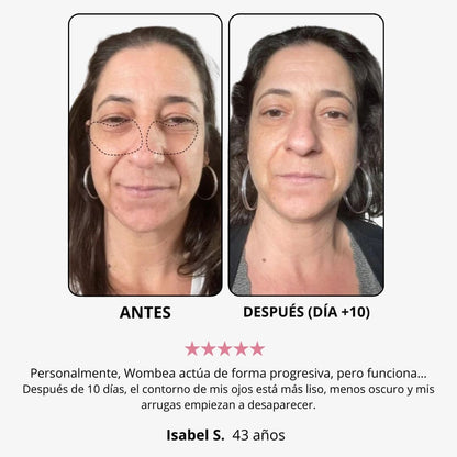 Crema de luz roja “eliminar ojos cansados”