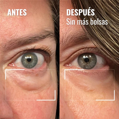 Crema de luz roja “eliminar ojos cansados”